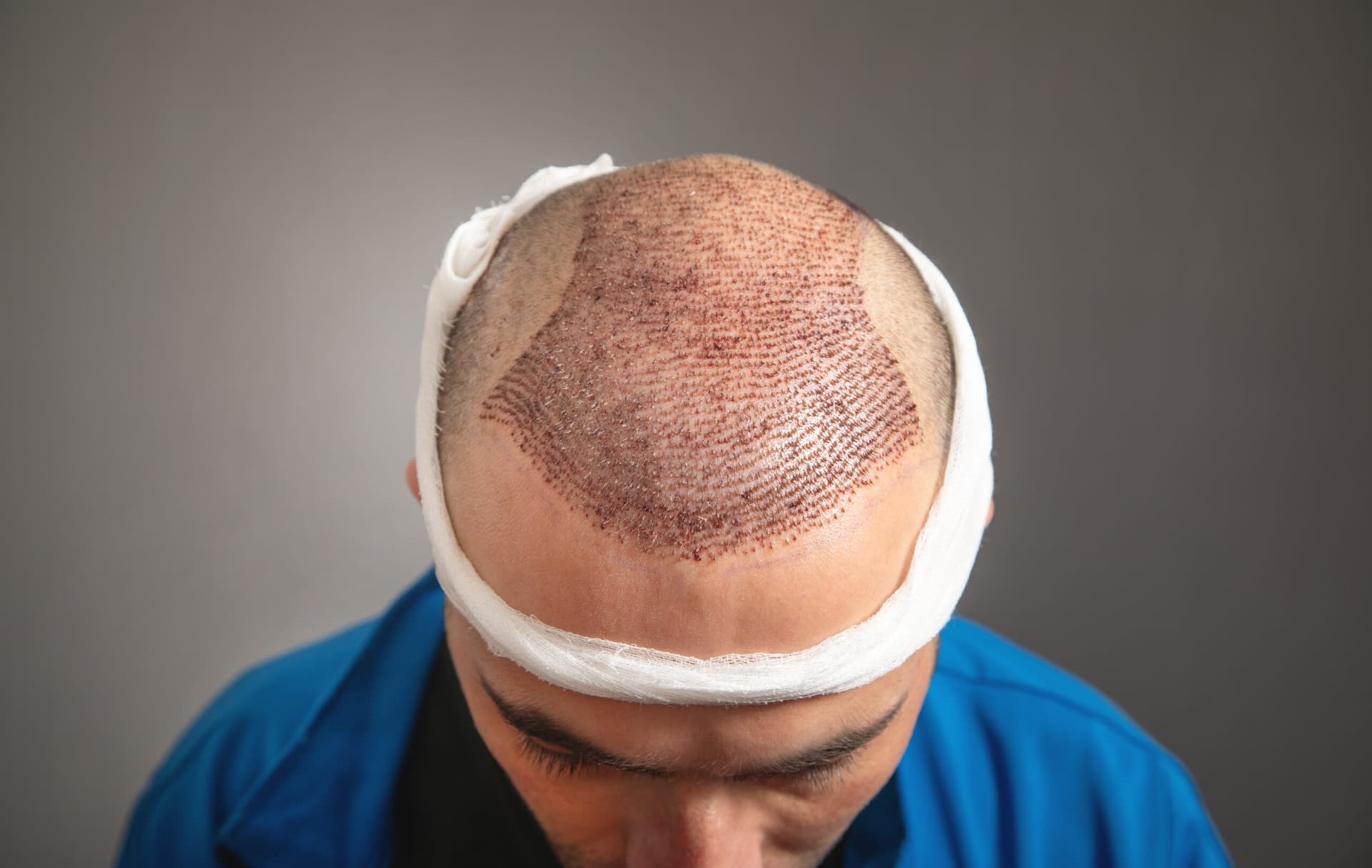 Real Hair Solutions for Men in NYC